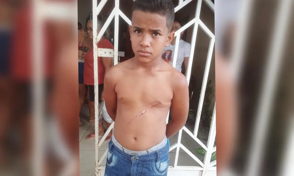 Garoto de 7 anos morre em incêndio em casa no interior do Ceará