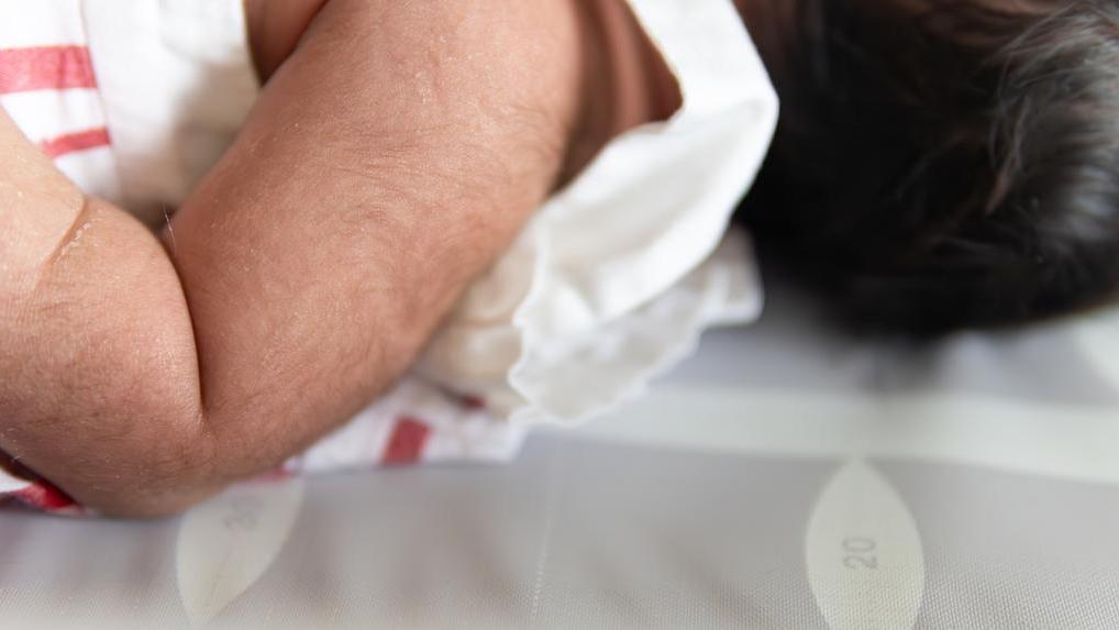 Minoxidil pode causar excesso de pelos em bebês, alerta Anvisa