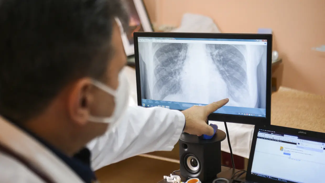 SAÚDE – Conheça os cinco tipos de câncer que mais matam no Ceará e saiba como se prevenir