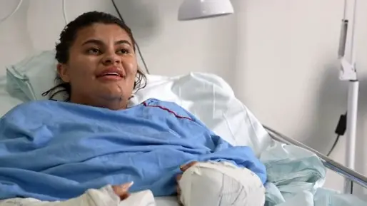REGIONAL – Ana Clara fala pela primeira vez sobre ataque que decepou suas mãos: ‘Sou um testemunho’