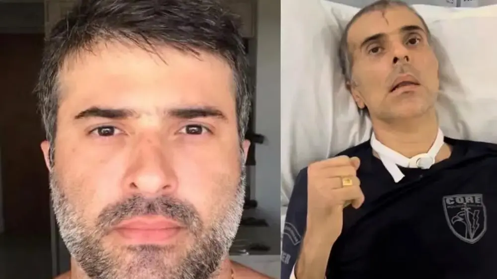 PAÍS – Morre Felipe Marques, policial baleado de fuzil na testa durante operação no RJ
