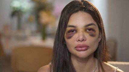 POLÍCIA – Dentista relata agressões que sofreu do marido, empresário da Faria Lima