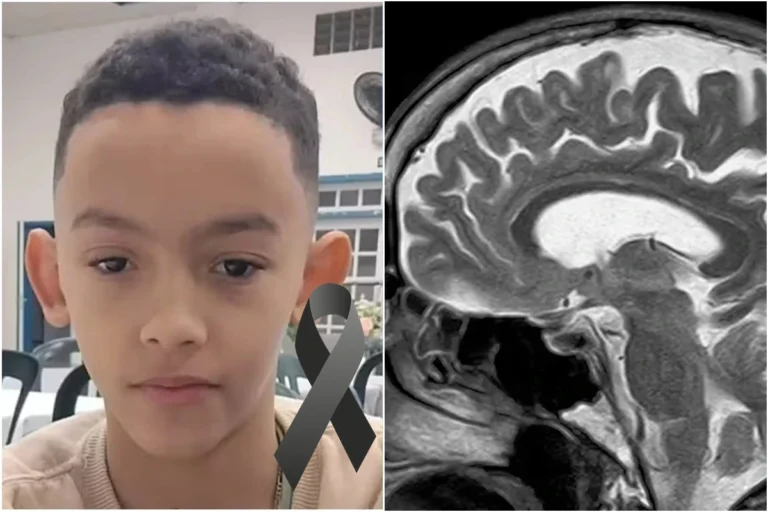 REGIONAL – Menino morre após bolada na cabeça em escola e caso acende alerta; ficar atento aos sinais é fundamental