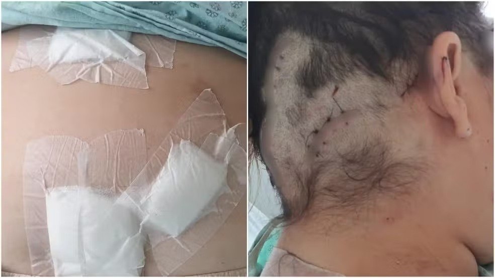 POLÍCIA – Mulher foi torturada e esfaqueada após companheiro ver conversa no celular dela sobre plano de sair de casa