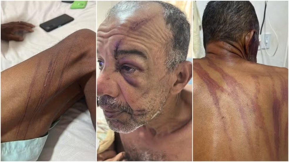 CEARÁ – ‘Simplesmente por ele ser negro, ser pobre’, diz filha de homem que denunciou agressões de seguranças em barraca de praia em Fortaleza